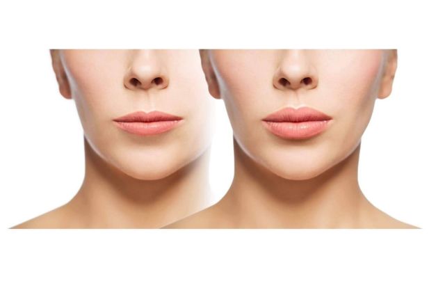 Los beneficios del ácido hialurónico en la salud bucal - 1, Foto 1