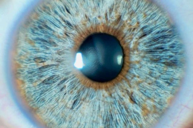 Las ventajas de la tecnología láser para cambiar el color de ojos - 1, Foto 1