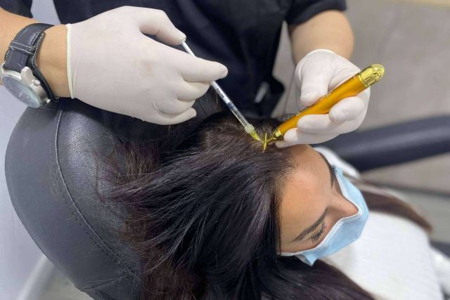 Servicio de injerto capilar en Alicante, con Élite Capilar - 1, Foto 1