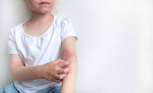 El resultado de los clientes después de utilizar los productos de Green Cornerss Care - 1, Foto 1