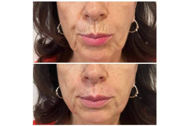 Clínica estética Cecilia Arthur, especialistas en blanching - 1, Foto 1