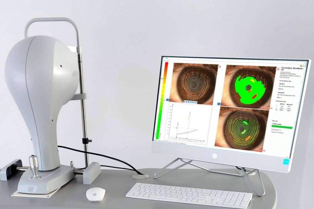GX2 dispone de topógrafos corneales, que ayudan a los facultativos a obtener los diagnósticos más precisos posibles - 1, Foto 1