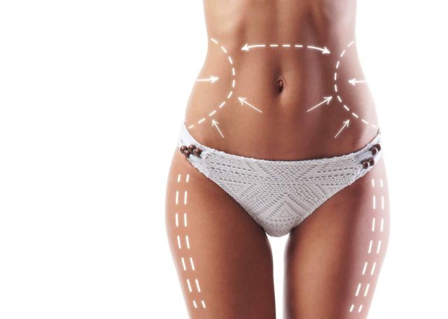 A2Clinic, especialistas en abdominoplastias en Barcelona - 1, Foto 1