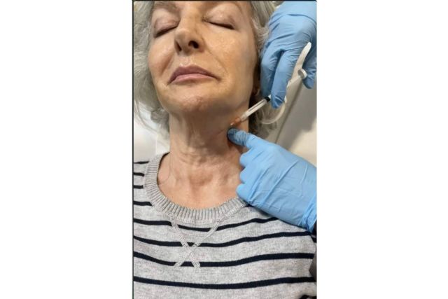 Técnicas de estimuladores de colágeno con Cecilia Arthur - 1, Foto 1