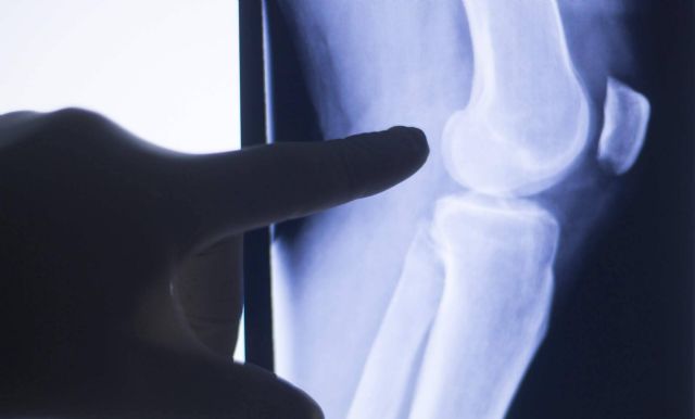 El traumatólogo en Bilbao Dr. Miguel Romero explica la importancia de cuidar las rodillas - 1, Foto 1