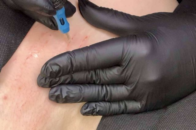 El método StopEstrías de Ideal Academy By Pilar Rico llega a España como una solución eficaz para la reducción y eliminación de estrías - 1, Foto 1