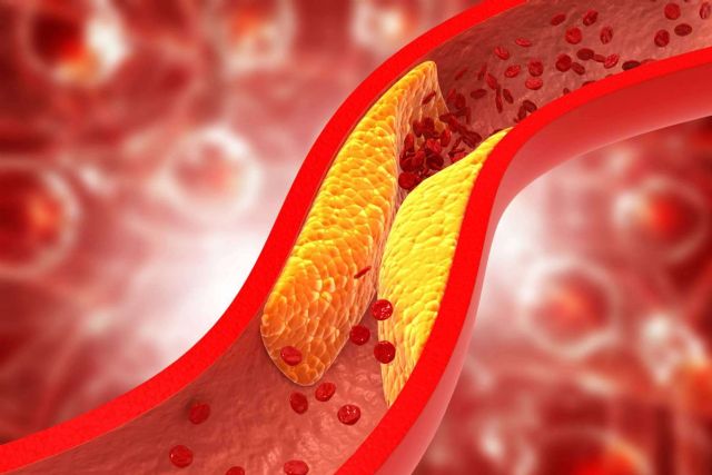 ReduCol 25, la fórmula innovadora con levadura roja de arroz rojo de Beverly Nutrition - 1, Foto 1