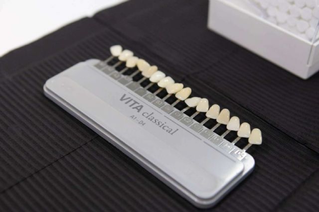 El diseño de sonrisa y la estética dental son la clave para lucir una sonrisa perfecta - 1, Foto 1