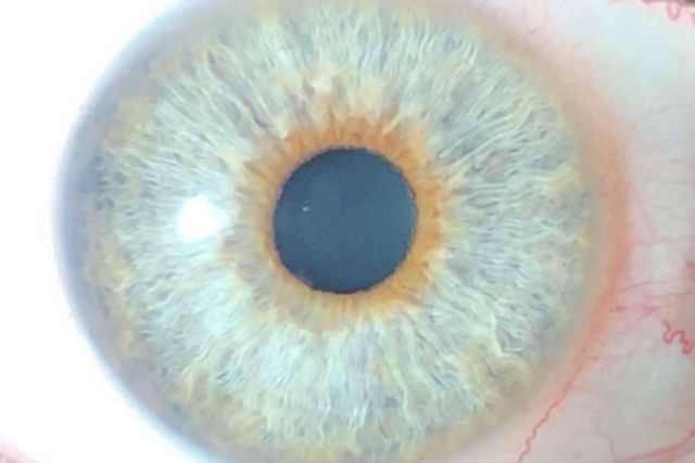 Distribución del color de ojos de la mano de Eyecos - 1, Foto 1