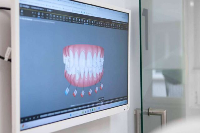 Tratar la maloclusión dental con CLÍNICA CRISTINA VIYUELA + CO y la ortodoncia invisible Invisalign - 1, Foto 1