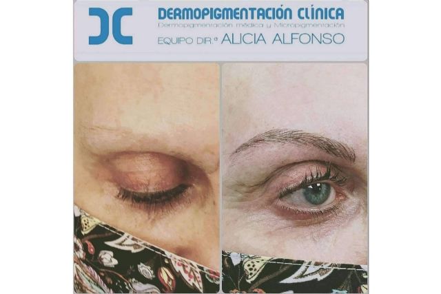 ¿Cuáles son las principales diferencias entre micropigmentación y microblading? - 1, Foto 1