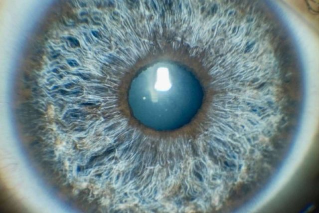 Predecir y simular en 3D el resultado del cambio de color de ojos con láser es posible con Eyecos - 1, Foto 1