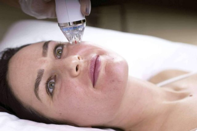 Técnica de resurfacing facial para mejorar la piel del rostro, con Alluring Clinic - 1, Foto 1
