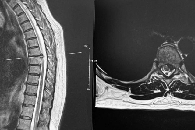 El neurocirujano Dr. Carlos Botella-Asunción es especialista en cirugía de hernia discal - 1, Foto 1