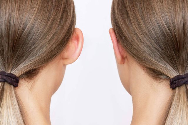 Operación y cirugía otoplastia en Centro Médico El Pilar - 1, Foto 1