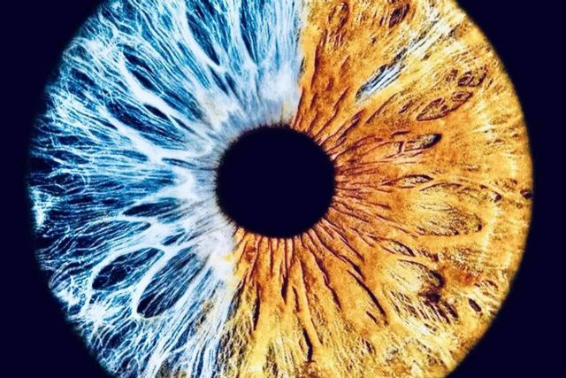 ¿Qué son las heterocromías congénitas?, por Eyecos - 1, Foto 1