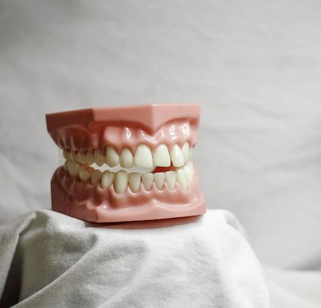 El Centre Dental Francesc Macià explica los consejos para cuidar los grills dentales - 1, Foto 1