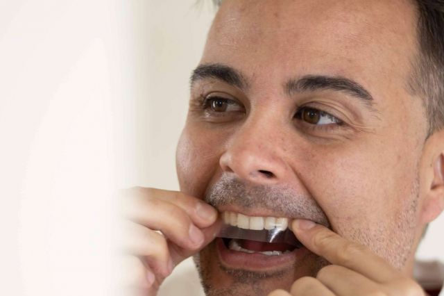 Llega el blanqueamiento que no quema las encías; Las tiras creadas por dentistas sin peróxidos - 1, Foto 1
