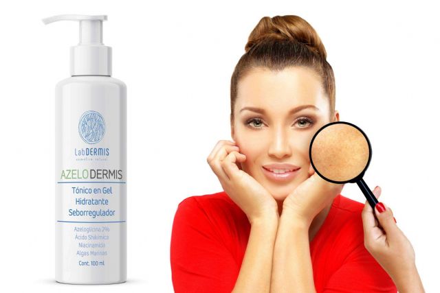 ¿Qué dicen los especialistas sobre el acné? - 1, Foto 1