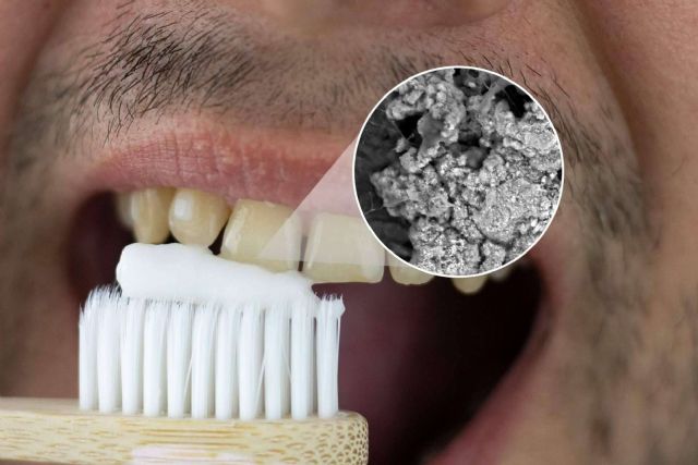 Firma dental murciana líder en blanqueamiento dental en casa - 1, Foto 1