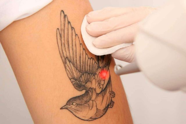 360Clinics revoluciona la eliminación de tatuajes con picolaser, un método eficaz y seguro - 1, Foto 1