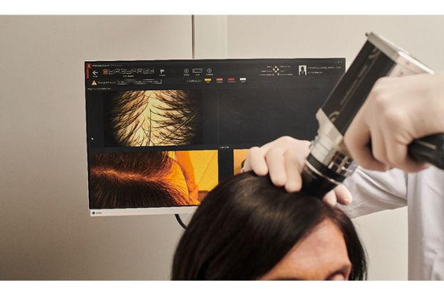 Mesoterapia capilar: el tratamiento que te ayudará a ganar densidad y frenar la caída durante o después del verano - 1, Foto 1