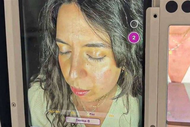 La revolución en la prevención y tratamiento de los daños solares; sinergia entre la tecnología Meesma y la protección solar de Sibari Republic - 1, Foto 1