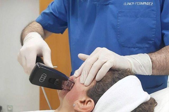 Clínica Fernández incorpora el tratamiento Morpheus8: tecnología mínimamente invasiva para rejuvenecimiento facial y corporal - 1, Foto 1