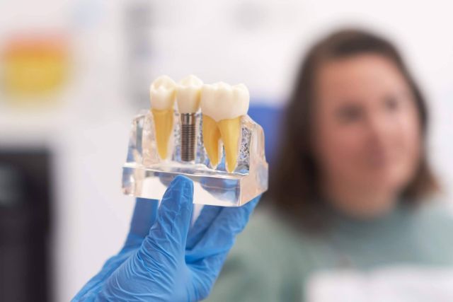 Los implantes dentales de carga inmediata, una alternativa rápida y segura para recuperar la sonrisa - 1, Foto 1
