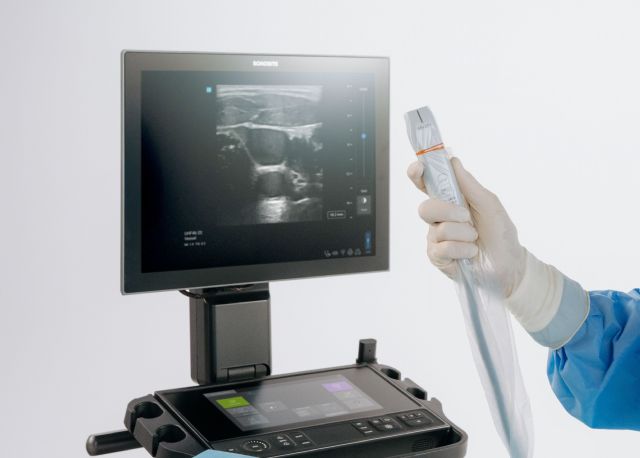 Sonosite LX introduce la ultra-alta frecuencia en POCUS con el primer y único transductor de 46 MHz - 1, Foto 1