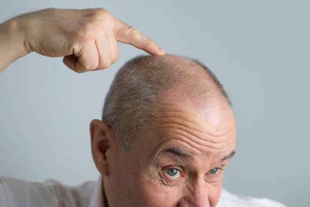 Xpecia Hombre combate la alopecia androgénica con una fórmula específica para frenar la caída del cabello - 1, Foto 1