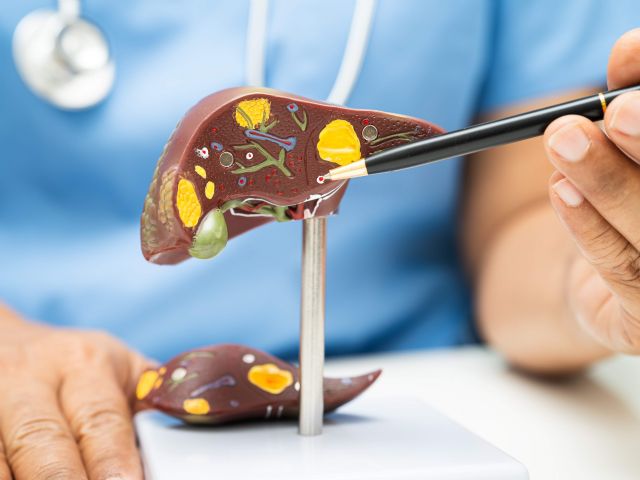 Dr. Juan Arenas, especialista en Aparato Digestivo de Policlínica Gipuzkoa: La pérdida de peso es la clave para mejorar el hígado graso y el síndrome metabólico - 1, Foto 1