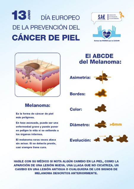 13 de junio, Día Europeo de la Prevención del Cáncer de Piel - 1, Foto 1