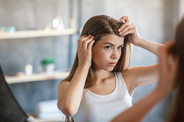 La dermatitis seborreica y su vinculación real con la caída del cabello - 1, Foto 1