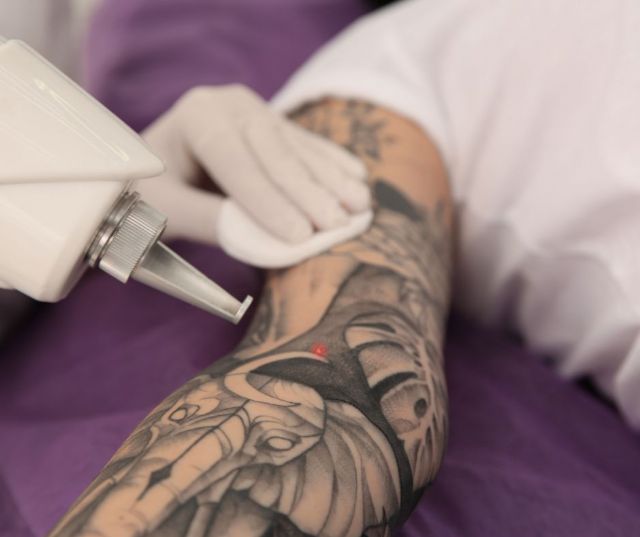 El 42% de los españoles se ha realizado al menos un tattoo y el 60% de ellos se arrepiente y busca eliminarlo - 1, Foto 1