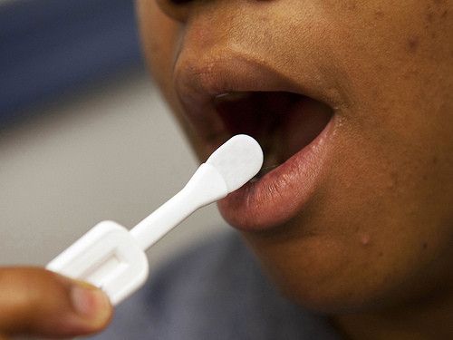 No Te Prives organiza su segunda Semana Europea de la Prueba del VIH