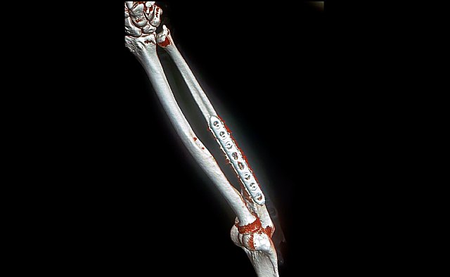 José María Trigueros volverá a pasar por quirófano - 2, Foto 2