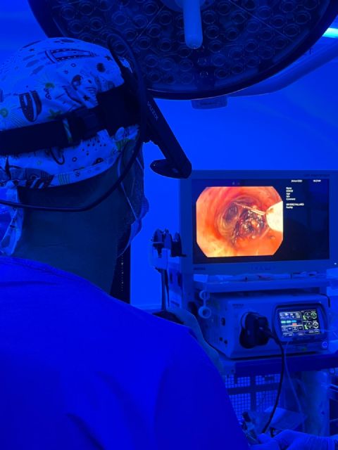 El hospital Santa Lucía aplica con éxito una técnica pionera en la Región para tratar el cáncer de pulmón - 1, Foto 1