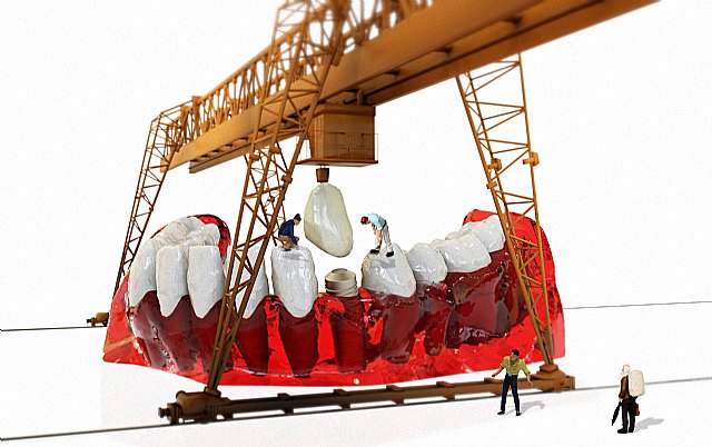 En España, se colocan más de 1,5 millones de implantes al año - 1, Foto 1