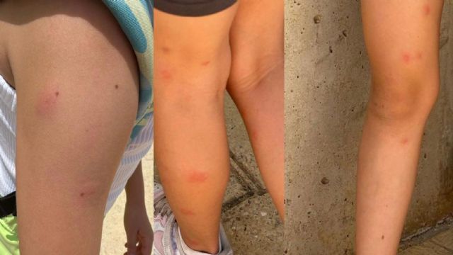 Jódar: Exigimos la fumigación inmediata en los colegios de Lorca para erradicar las plagas de insectos que tiene a nuestros menores llenos de picaduras - 1, Foto 1