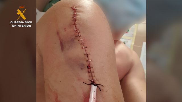 La Guardia Civil esclarece la agresión a un joven en Sucina-Murcia - 3, Foto 3