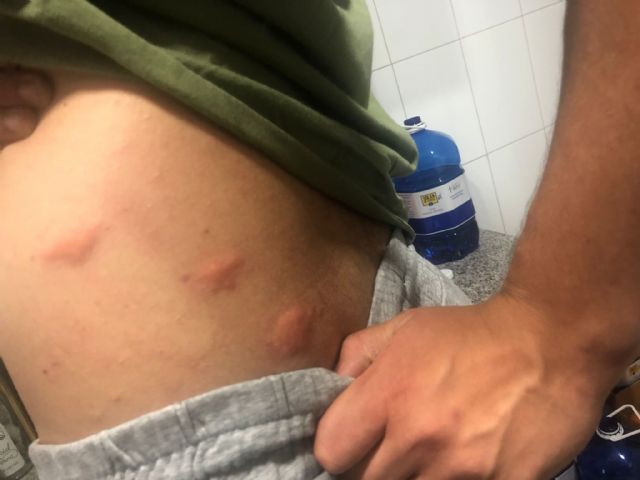 El PP propone iniciar fumigaciones extraordinarias e intensas ante la preocupante proliferación de insectos, mosquitos y moscas en pedanías y casco urbano - 1, Foto 1