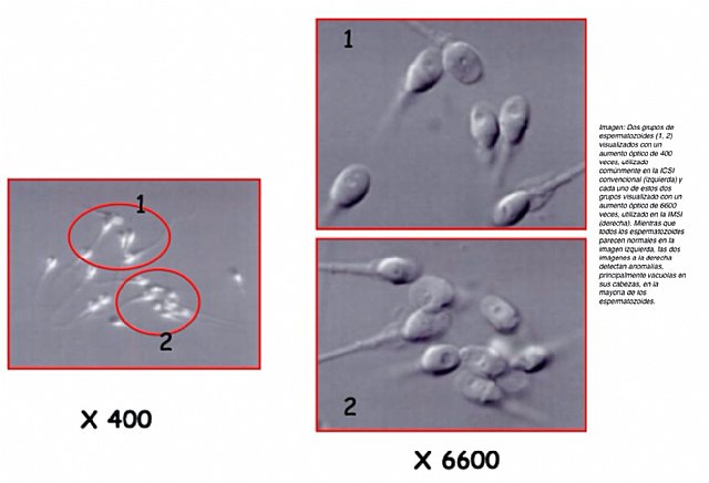 Un estudio confirma que la técnica IMSI es mejor que la ICSI en casos de infertilidad masculina - 1, Foto 1