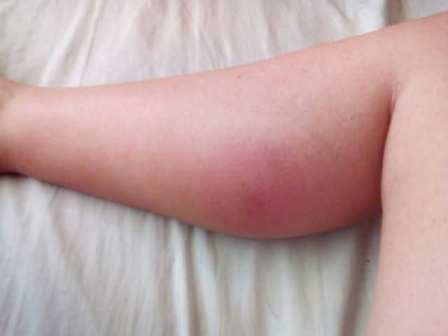 Cambiemos Murcia pide al Ayuntamiento que combata la plaga de mosquitos en Beniaján y Puente Tocinos - 2, Foto 2