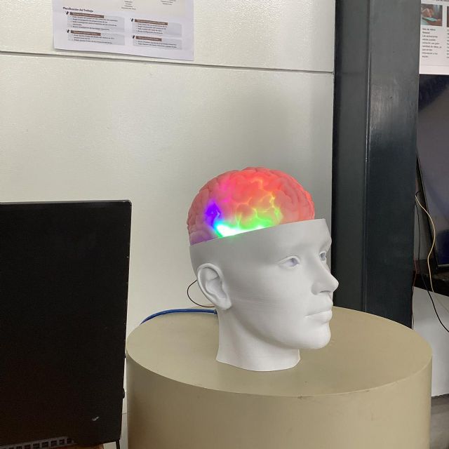 Alzheimer: Científicos peruanos combinan IA y simulación 3D para la detección temprana y evitar el avance de esta enfermedad - 2, Foto 2