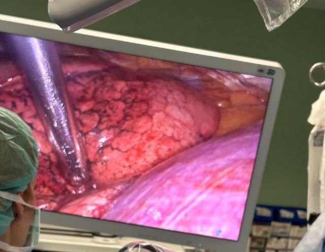 La Arrixaca comienza a aplicar una novedosa técnica en la Región para tratar pequeños tumores de difícil acceso - 1, Foto 1