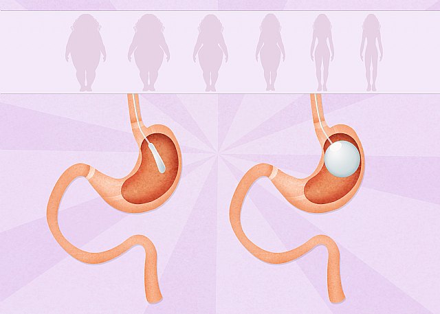 Foto: <a href=https://sp.depositphotos.com/ rel=nofollow target=_blank>Depositphotos</a>, Foto 1