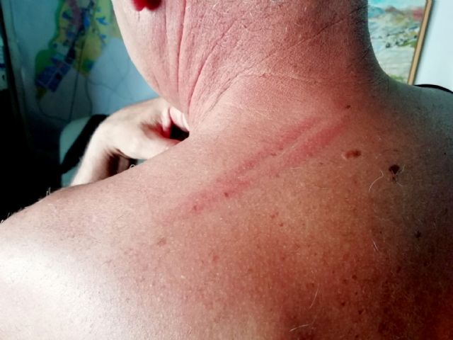 Agreden a un concejal de IU-Verdes en Lorca que salió en defensa de una familia que estaba siendo apedreada en el barrio de San Cristóbal - 1, Foto 1