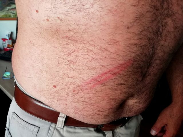 Agreden a un concejal de IU-Verdes en Lorca que salió en defensa de una familia que estaba siendo apedreada en el barrio de San Cristóbal - 2, Foto 2