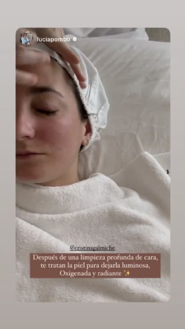 La generación Z pierde el miedo a enfrentarse al acné - 2, Foto 2